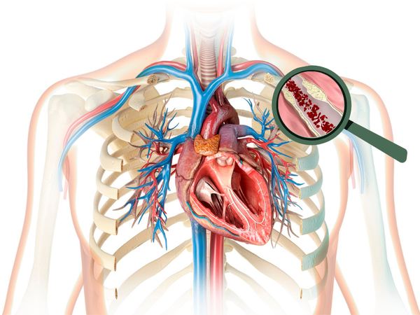 ლიპიდური ცვლის პანელი